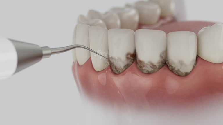 Reliable Dental Implants contractor in Big Pine Key, FL by Smile Center Dentistry